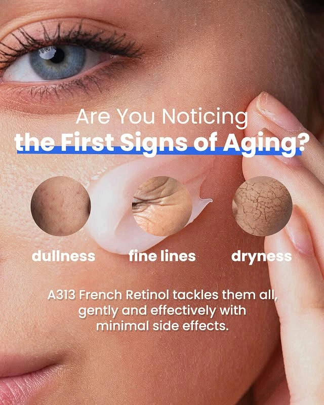 A313™ Retinol Cream 50g – Gentle Vitamin A Retinoid Pomade